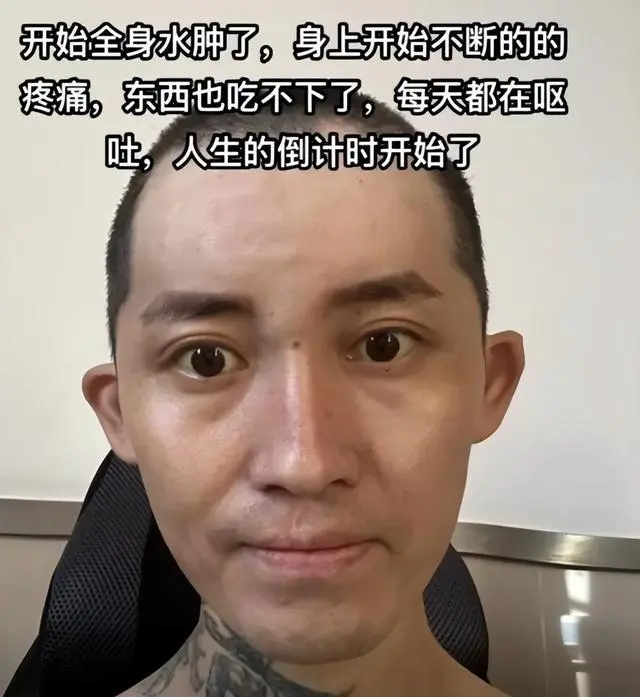 29岁抗癌网红大飞去世_抗癌飞飞_抗癌离世